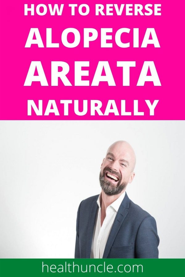 how to treat alopecia areata naturally