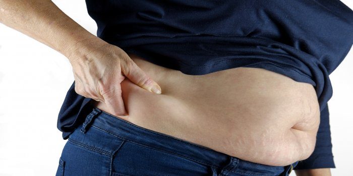 how to treat erectile dysfunction caused by obesity